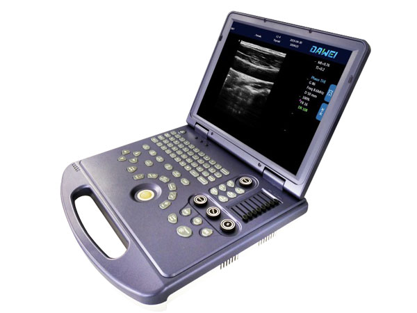 便攜式獸用超聲診斷儀MU15